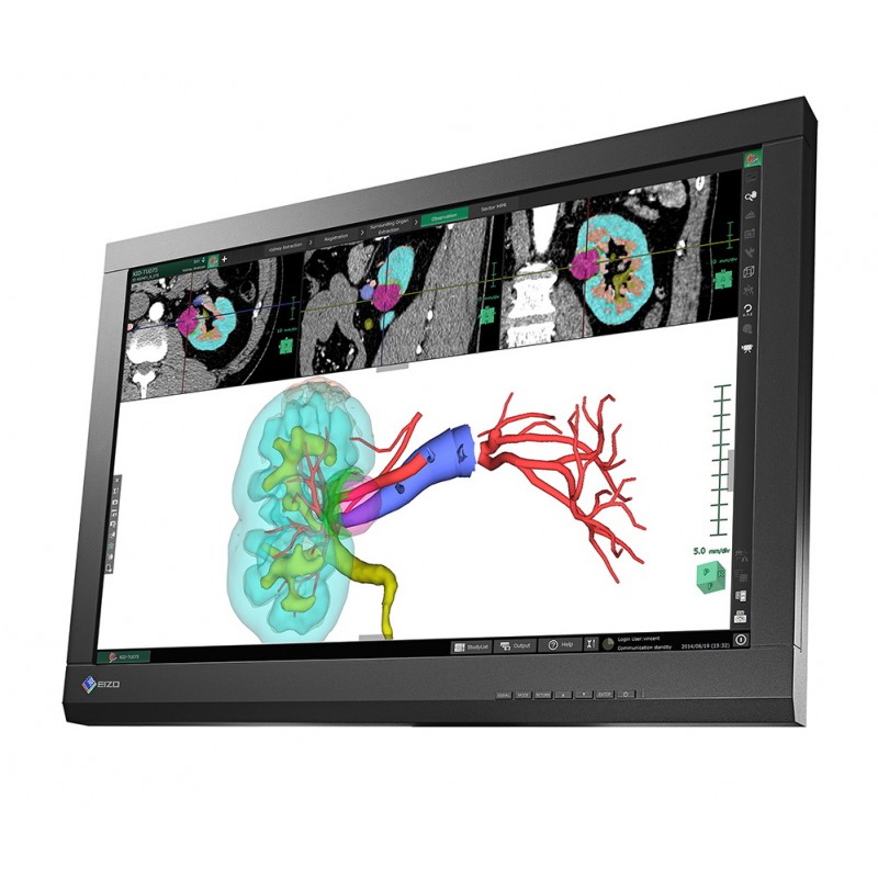Skärmar begagnade - Eizo RadiForce MX242W 24-tums LED-skärm med IPS-panel (beg utan fot - kan köpas separat)